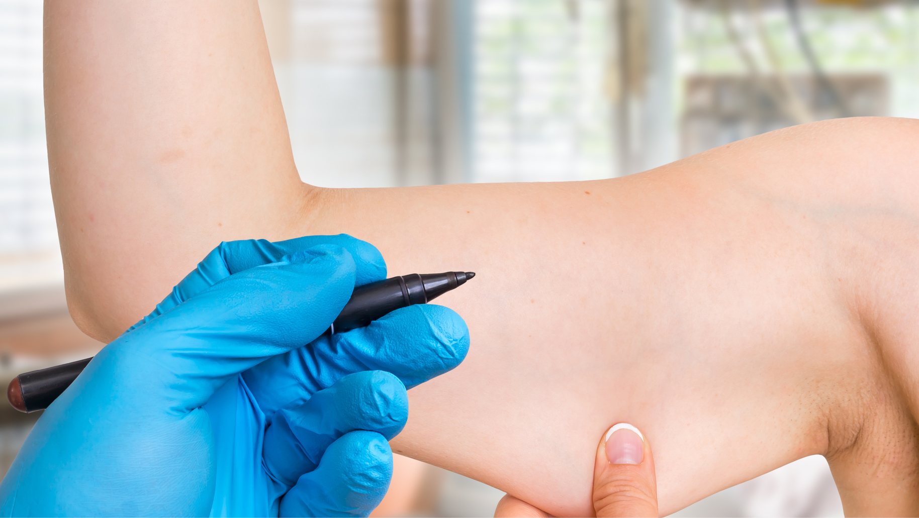 Plastic Surgery Dubai 