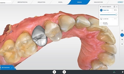 tooth crown dubai